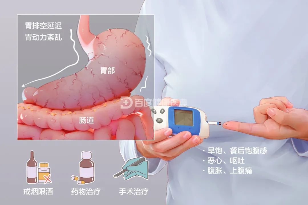 【健康小贴士】糖友经常腹胀、恶心，要当心糖尿病胃轻瘫